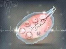 胚胎移植后为什么会便秘？知道原因后试下这些处理办法